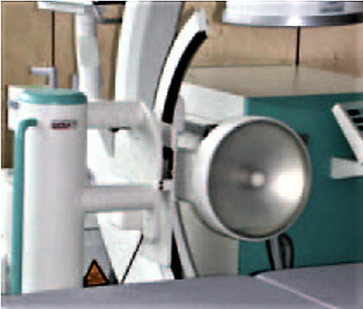 Piezoelectric Therapy to Treat Gall or Kidney Stones